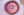 Figure 1. Traumatic cataract in a 7-year-old boy after blunt trauma to the right eye. The pupil is pharmacologically dilated, but several iris tears are visible. The patient also has anterior capsular scarring and a posterior subcapsular cataract.