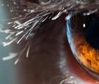 Intermittent Pain and Corneal Scarring
