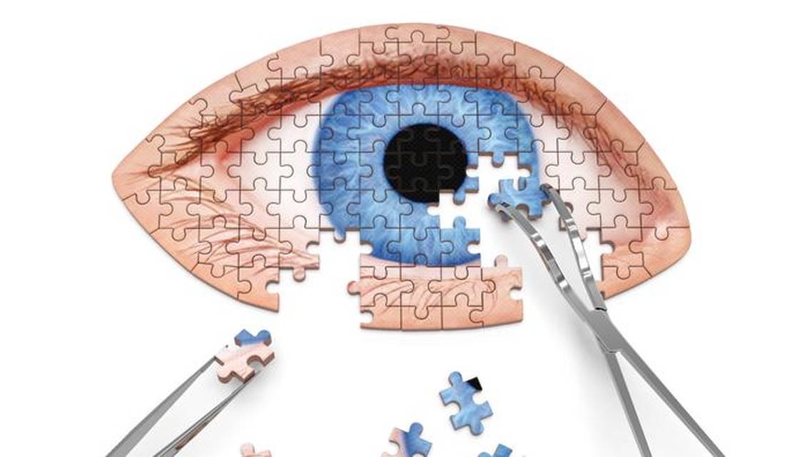 Whats Happening With Bilateral Cataract Surgery