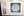 Figure 2. Screen view during a treatment with good dilation and centration. The infrared view shows an overlay of the aiming reticle. The blue circle represents the center of the IOL as detected by the LDD software’s passive Align Assist alert feature.