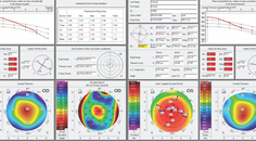 Unreadable Keratometry