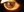 Figure 1. External photograph of the right eye. Inferonasal extrusion of the IOL haptic is evident.