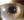Figure 3. Slit-lamp photograph of the telescopic device 2.5 years after implantation.