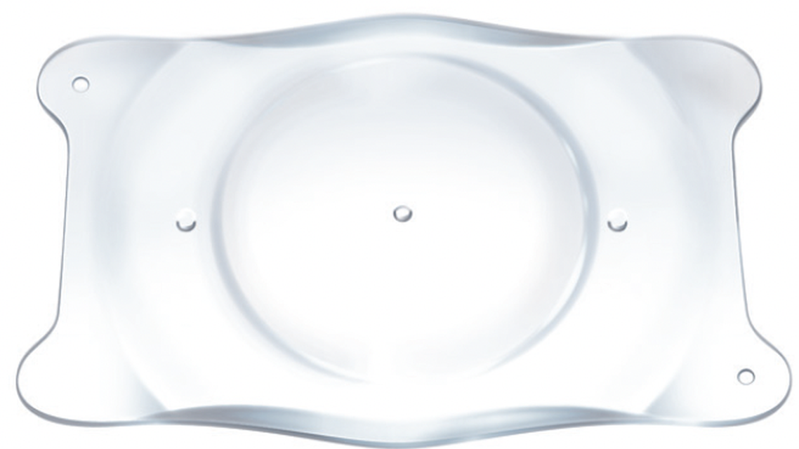 Recommending the EVO ICL to Patients