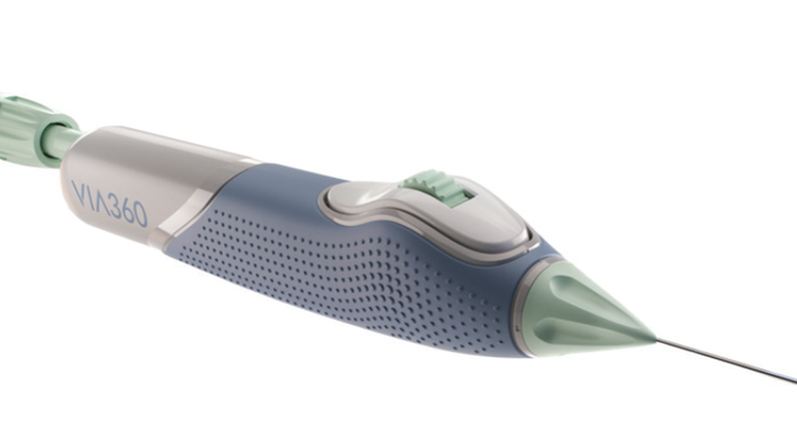 Innovative 360 Catheterization and Ease of Viscoelastic Delivery With VIA360 Surgical System