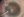 Figure 5. A CTS and iris hook are used to stabilize the
capsular bag before horizontal chop and phacoemulsification
are performed.