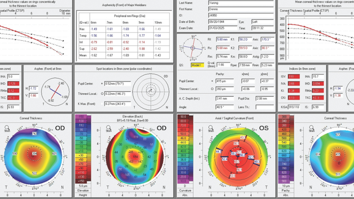 Unreadable Keratometry