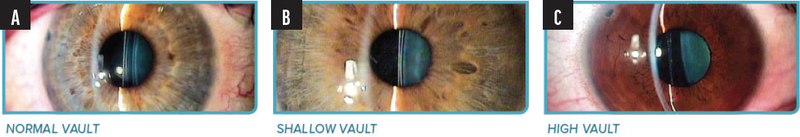 What You Can Expect With Patient Outcomes