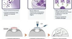 Corneal Endothelial Cell Therapy