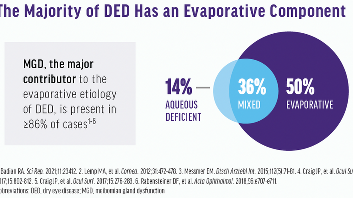 A Paradigm Shift in Evaporative Dry Eye Disease Management