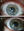 Figure 6. Healing with reduced scarring 7 weeks after flap amputation (A). Healing with scarring limited to the anterior stromal bed 7 weeks after flap amputation (B).