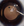 Figure 1. Intraoperative image of an EVO ICL in situ.