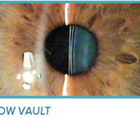 What You Can Expect With Patient Outcomes