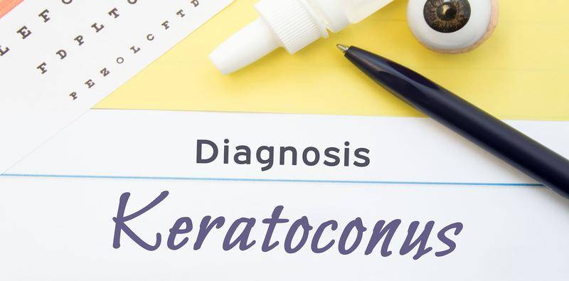 I Underwent CXL to Treat My Keratoconus