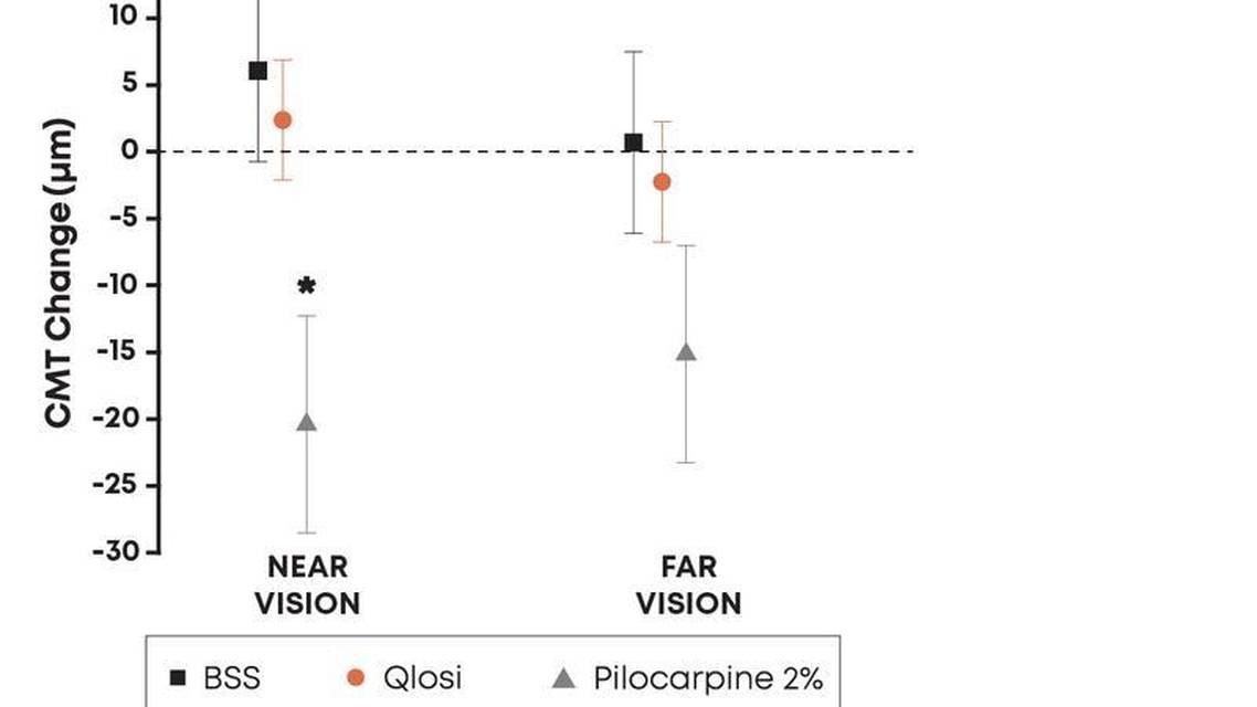 Formulation Matters New Data Demonstrates Qlosi is Pupil Selective