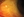 Figure 1. Side view of the VisAbility microinsert in vivo.