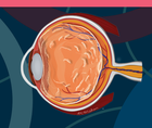 Best Practices on Referring Patients With Symptomatic Vitreous Opacities