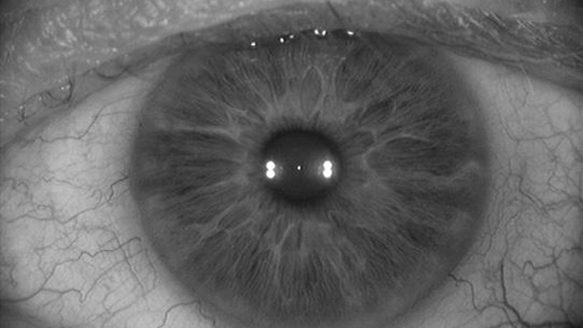 The Current Cataract Refractive Landscape