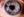 Figure 14. Three months after surgery, a slit-lamp examination of the left eye showed the iridoplasty suture and several round areas of depigmentation from iris cautery. Note the stability of the thermal damage from immediately after surgery (Figure 13) to 3 months postoperatively. Several nylon sutures from the patient’s previous ruptured globe repair were visible at the nasal limbus.