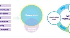 Differentiated Treatments for Dry Eye Disease DED