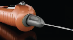 Allograft Placement Using the CycloPen System