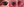 Figure. A large, pigmented, conjunctival lesion with prominent feeder vessels extends from the temporal perilimbal conjunctiva over the cornea.