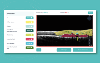 Altris Receives FDA Clearance of Altris IMS Platform for OCT Scan Analysis image