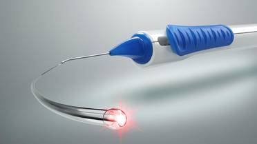 Nova Eye Medical Announces US Market Clearance of the iTrack Advance Canaloplasty Device image