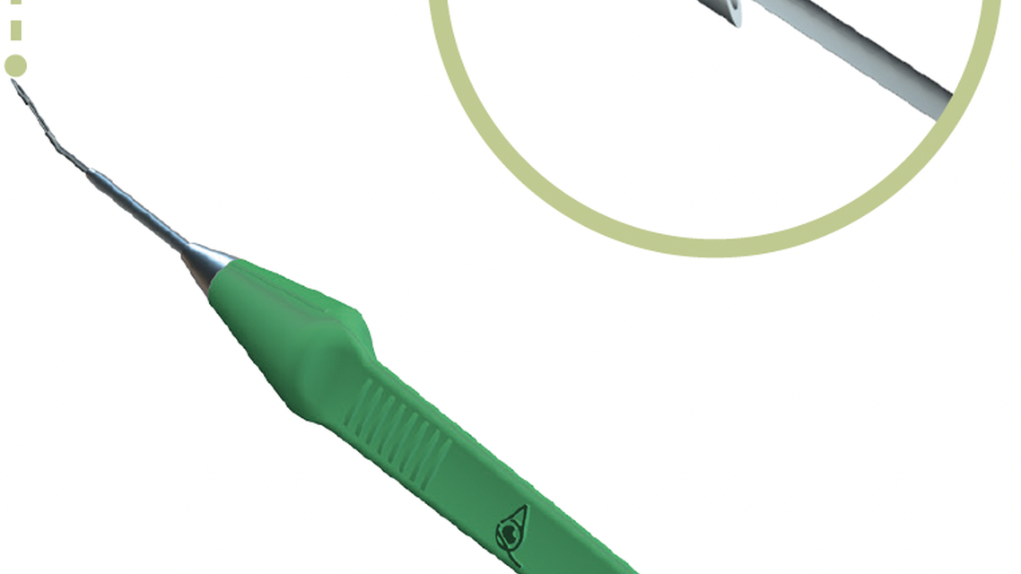 AquaLumen for IOP Management