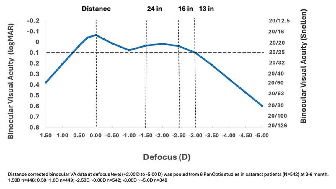 A Trifocal IOL with Proven Performance