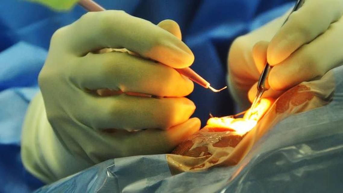 Ensure Toric IOLs Stability