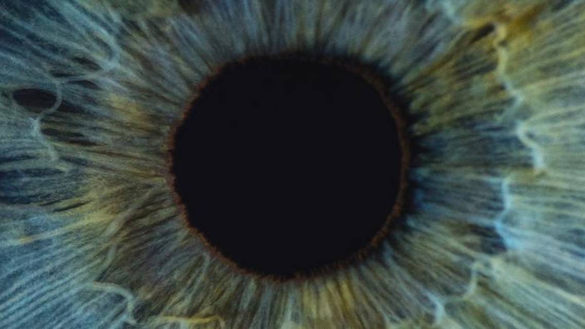Flanged Intrascleral Haptic Fixation