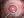 Figure 1. Dr. Singh performs limited vitreous floater removal using the 1-Step single-use vitrector (Vista Ophthalmics).