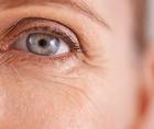 Pressure Induced Stromal Keratitis