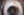 Figure 4. Round pupil at the end of the case.
Figures 1–4 courtesy of Kourtney Houser, MD