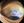 Figure 2. Conjunctival and episcleral pigmentation in the left eye.