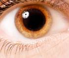 Intraoperative Miosis in Cataract Surgery