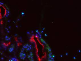 Novel Imaging Technology Reveals Role of Immune Cells in Early Diabetic Cataract Development image