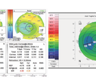 Achieving Spectacle Independence After LASIK