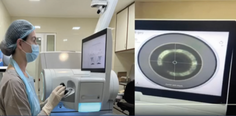 ZEISS VISUMAX 800 Redefining Refractive Surgery with Unmatched Speed and Comfort