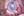 Figure 6. The surgeon used Utrata forceps to make the
capsulorhexis. The irregular pupil made creation of a
large capsulorhexis difficult.