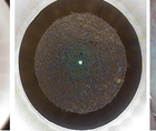 Refractive Surgery Mayday