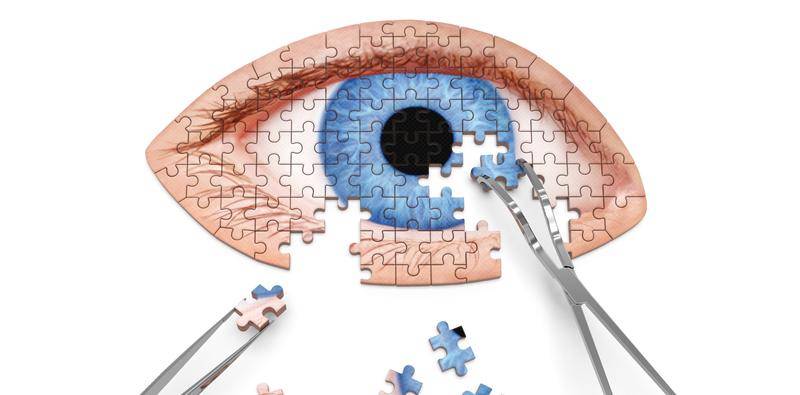 Whats Happening With Bilateral Cataract Surgery