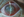 Figure 1. Neurotrophic keratitis.