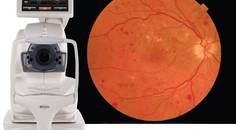 The Next Generation Automated OCT and Fundus Imaging System