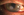 Figure 4. Progression of the infiltrate and ulceration through the LASIK flap.