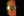 Figure 1. Inferiorly subluxated one-piece acrylic IOL–capsular bag complex in a patient with pseudoexfoliation. Note the exfoliative material at the pupillary margin.