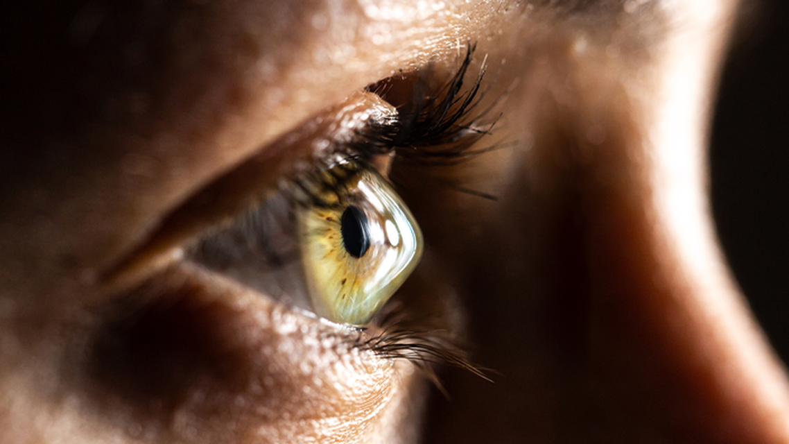 Supporting and Identifying Patients With Keratoconus