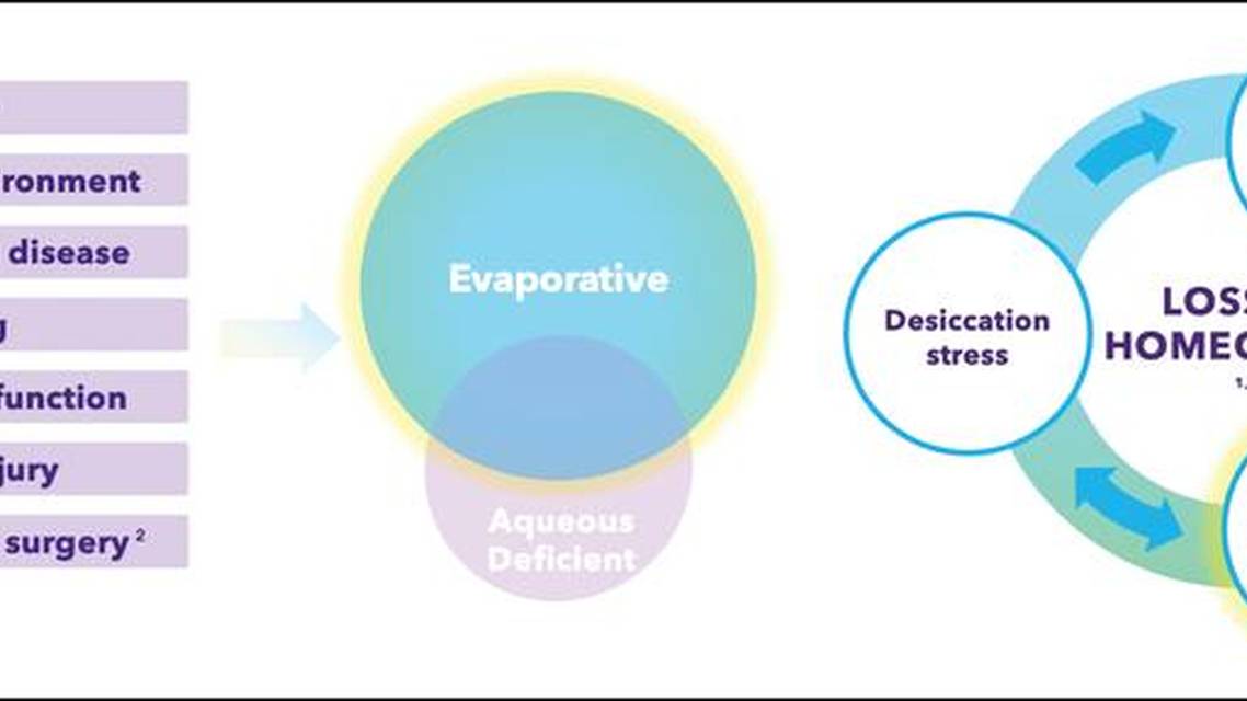 Differentiated Treatments for Dry Eye Disease DED