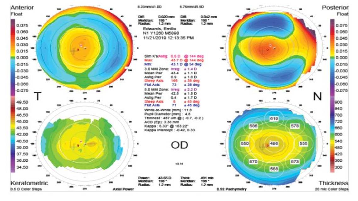 AvaGenandx2122 The Genetic Eye Test in Modern Practice